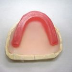 総入れ歯製作の咬み合わせ