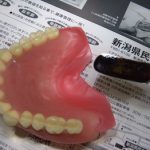 入れ歯の非適応について。