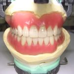 自分の健康な歯に勝るものは入れ歯では作れません。
