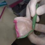 入れ歯ための型取り