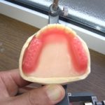 入れ歯のための歯の排列