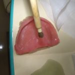 入れ歯の修理のこと