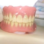 嘔吐反射を持つ人の、入れ歯の対応。