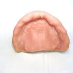 入れ歯のための粘膜調整剤の使用について