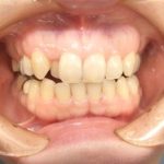 あなたの歯は何本ありますか？