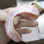 総入れ歯でも３ヵ月に１回は点検しましょう。