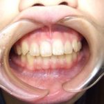 歯科は慢性疾患が対象となることが多いです。