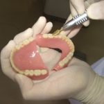 歯の欠損はありますか？