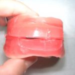 総入れ歯の、咬み合わせを決める作業は大変です。