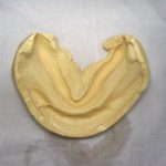 総入れ歯の型取りは慎重に行っています。