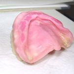 入れ歯でできる傷について。。。