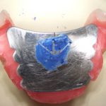 総入れ歯の顎の位置関係を診る作業は大変です。